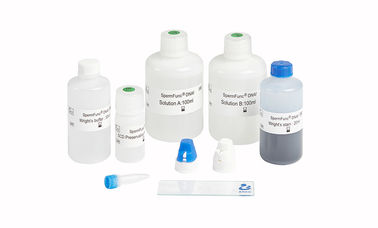 Economical Sperm DNA Fragmentation Test Kit For DNA Fragmentation Level Determination--sperm chromatin dispersion method